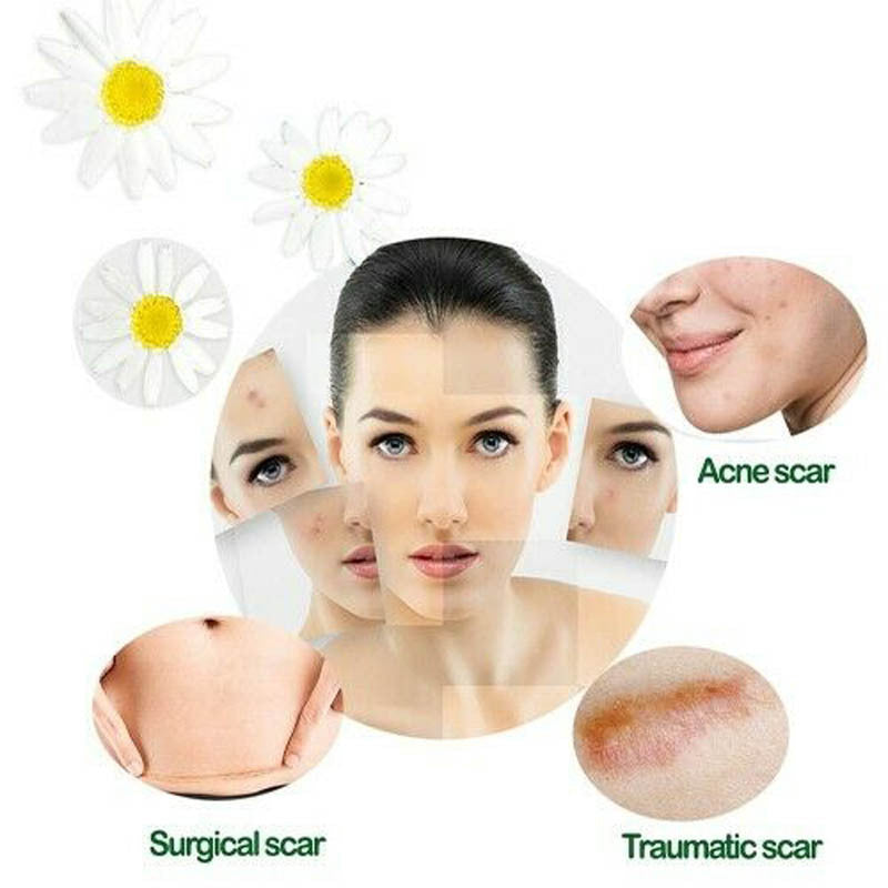 Vietnamese Original Snake Skin care lotion